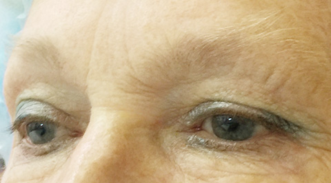 Eyebrows before Permanent MakeUp - Micropigmentation in Healthy Looks in Rufford Newark UK