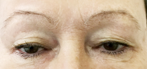 Eyebrows before Permanent MakeUp - Micropigmentation in Healthy Looks beauty salon in Rufford UK