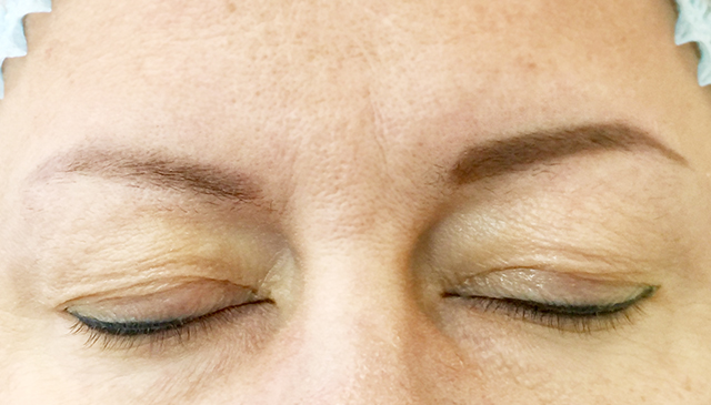 Half face before, other after Permanent MakeUp - Healthy Looks