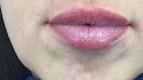 Lips after Permanent MakeUp - Micropigmentation - Healthy Looks beauty salon in Rufford Newark UK