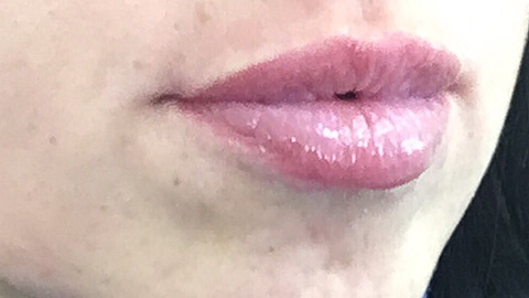 After Lips Micropegmantation - Permanent MakeUp in Healthy Looks beauty salon in Rufford Newark UK