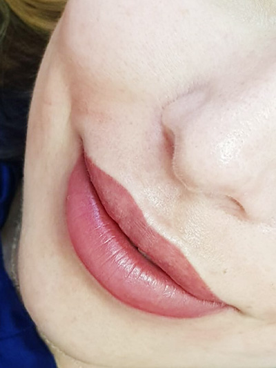 Lips Permanent MakeUp - Micropigmentation