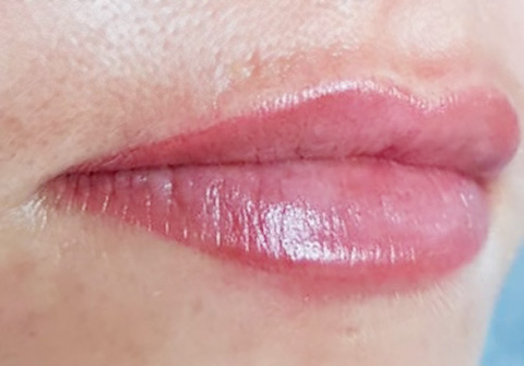 Lips after Permanent MakeUp - Micropigmentation in Healthy Looks beauty salon in Rufford UK