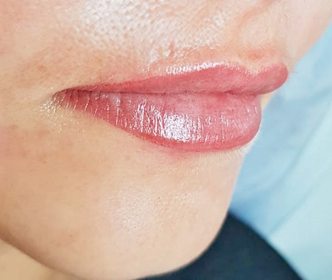 Lips after Permanent MakeUp - Micropigmentation in Healthy Looks beauty salon in Rufford UK