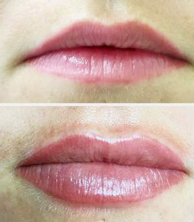 Lips before & after Permanent MakeUp - Micropigmentation - Healthy Looks beauty salon in Rufford Newark UK